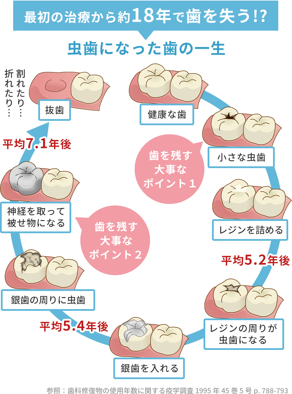 虫歯治療