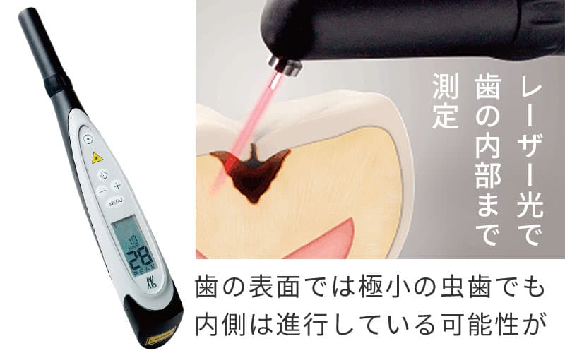 ダイアグノデント